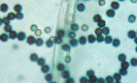 Spores of Aspergillus