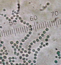 Spores of Penicillium