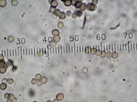 Spores of Syncephalastrum