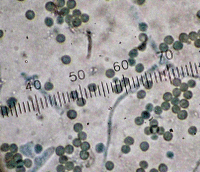 Spores of Trichoderma