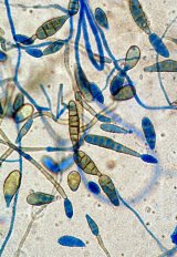 Alternaria