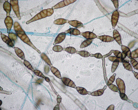 Alternaria alternata spores, picture