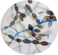 Spores of Alternaria as seen under a microscope