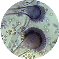 Heads and spores of Aspergillus fumigatus as seen under a microscope