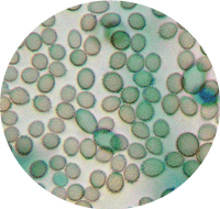 Spores of Aspergillus species from a tapelift sample