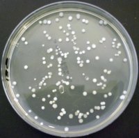 Bacteria Colonies On TSA Agar Media