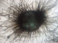Chaetomium globosum