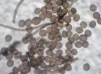 Chaetomium globosum spores