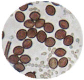 Spores of Chaetomium (large, brown) and Aspergillus (small, clear) as seen under a microscope