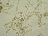 Cladosporium sphaerospermum picture