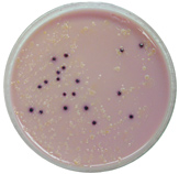 Colonies of E. coli (purple) grown from a water sample.
