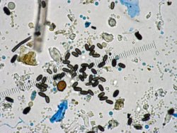 Stachybotrys, Aspergillus/Penicillium spores