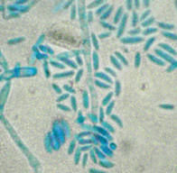 Spores (microconidia) of Fusarium