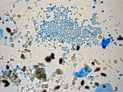 fungal spores