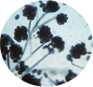 Mold Prevention