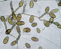 Ulocladium spores, picture