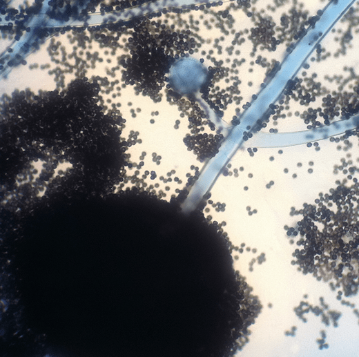 Asp 1
