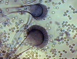 Difference Between Aspergillus Flavus Aspergillus Niger And Aspergillus Fumigatus