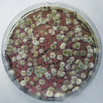 Mold types: Fungal Colonies